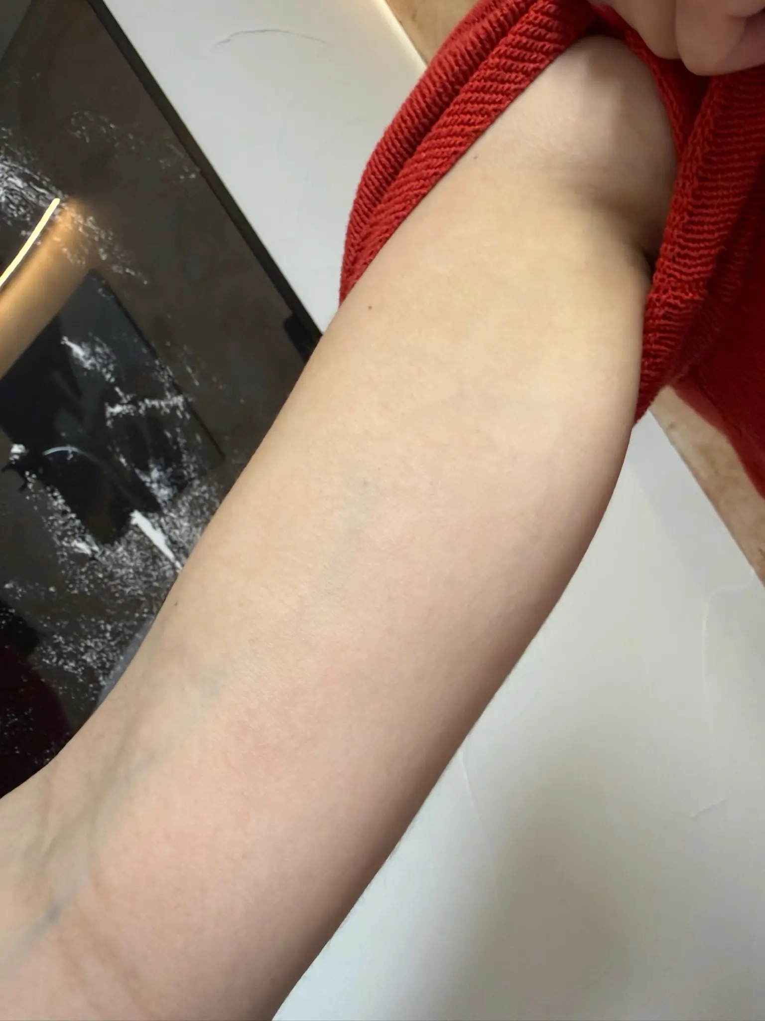 Après — Tatouage line-art bras — retrait complet