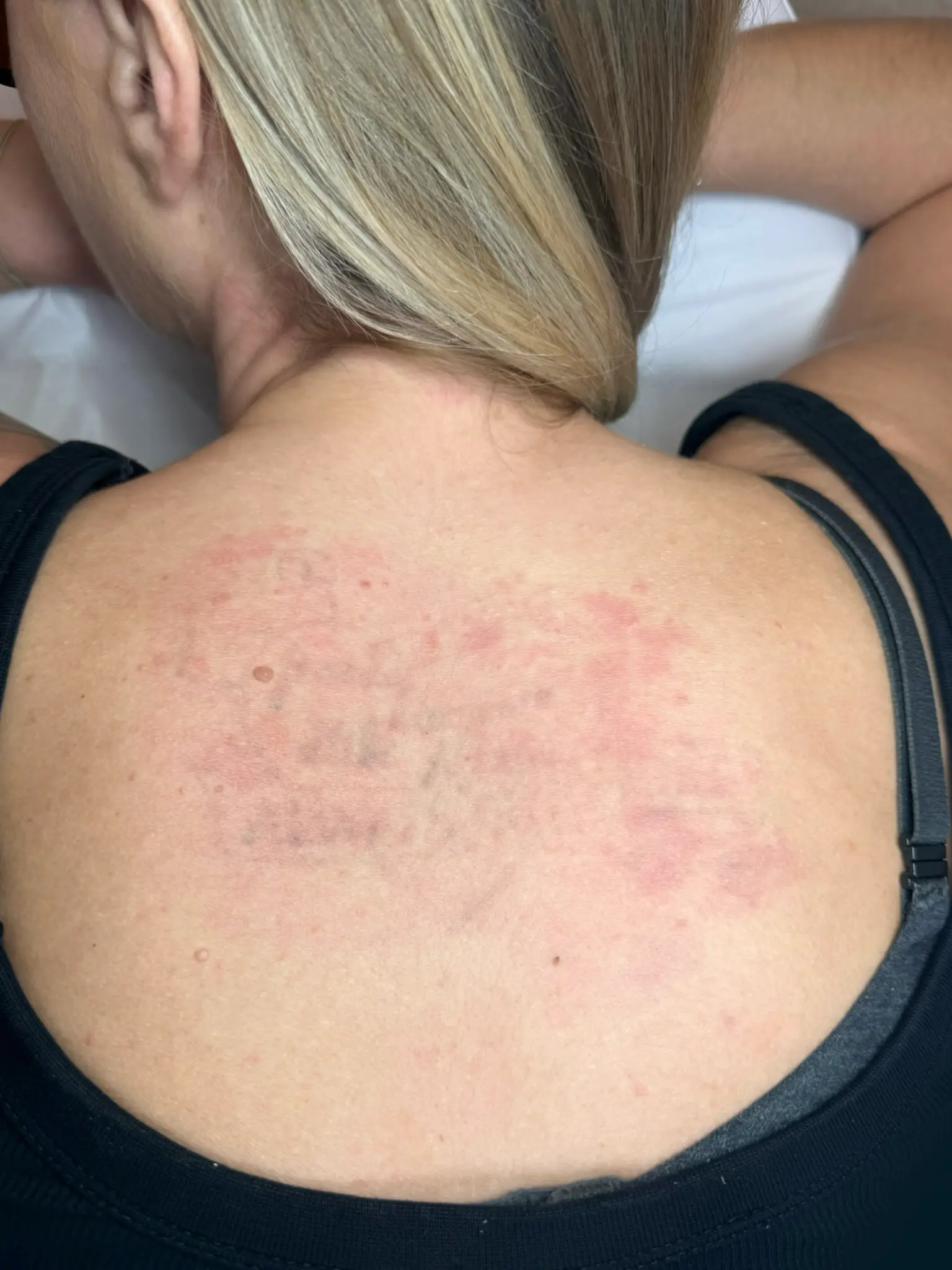 Après — Cœur prénoms haut du dos — atténuation en cours