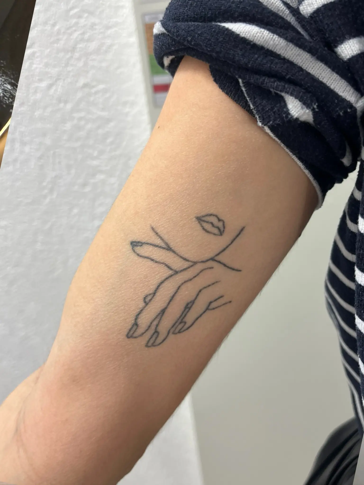Avant — Tatouage line-art bras — retrait complet